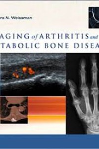 Imaging of Arthritis and Metabolic Bone Disease