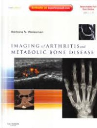 Image of Imaging of Arthritis and Metabolic Bone Disease